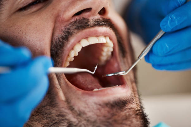 After-Hours Dental Trauma Care